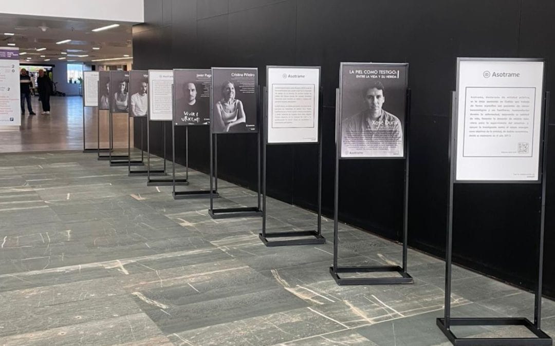 Recala en el HULA la exposición “La piel como testigo”, con pacientes de EICR como protagonistas
