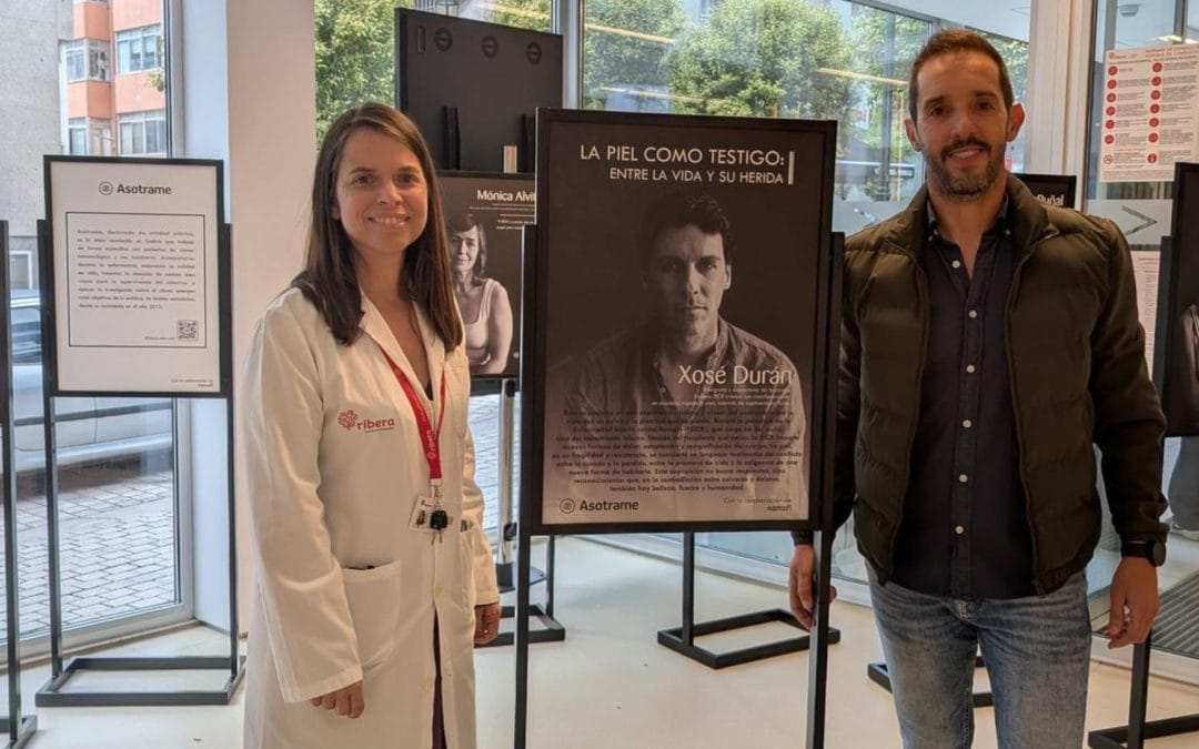 El Hospital Ribera Povisa acoge la exposición itinerante de Asotrame “La piel como testigo”