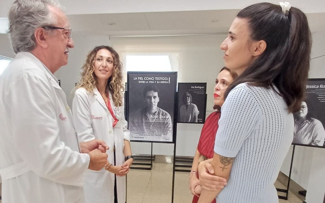El Hospital Ribera Juan Cardona acoge nuestra exposición itinerante “La piel como testigo»